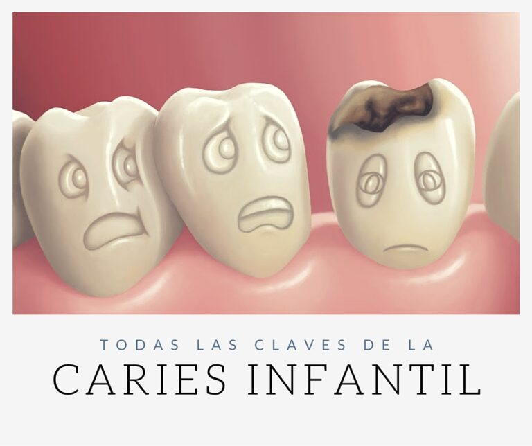 caries infantil