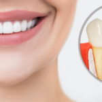 5. Implantes