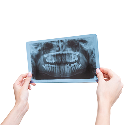 Tratamiento Cirugía y Traumatología Oral en Clínica Microdental