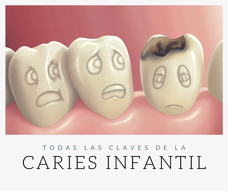 caries infantil