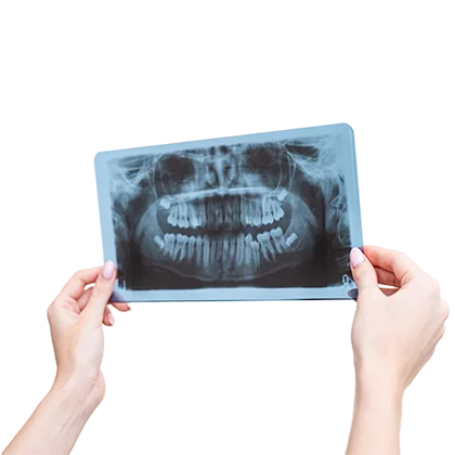 Tratamiento Cirugía y Traumatología Oral en Clínica Microdental